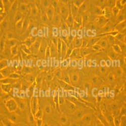 ZDF Rat Diabetic Endothelial Cells  (23)